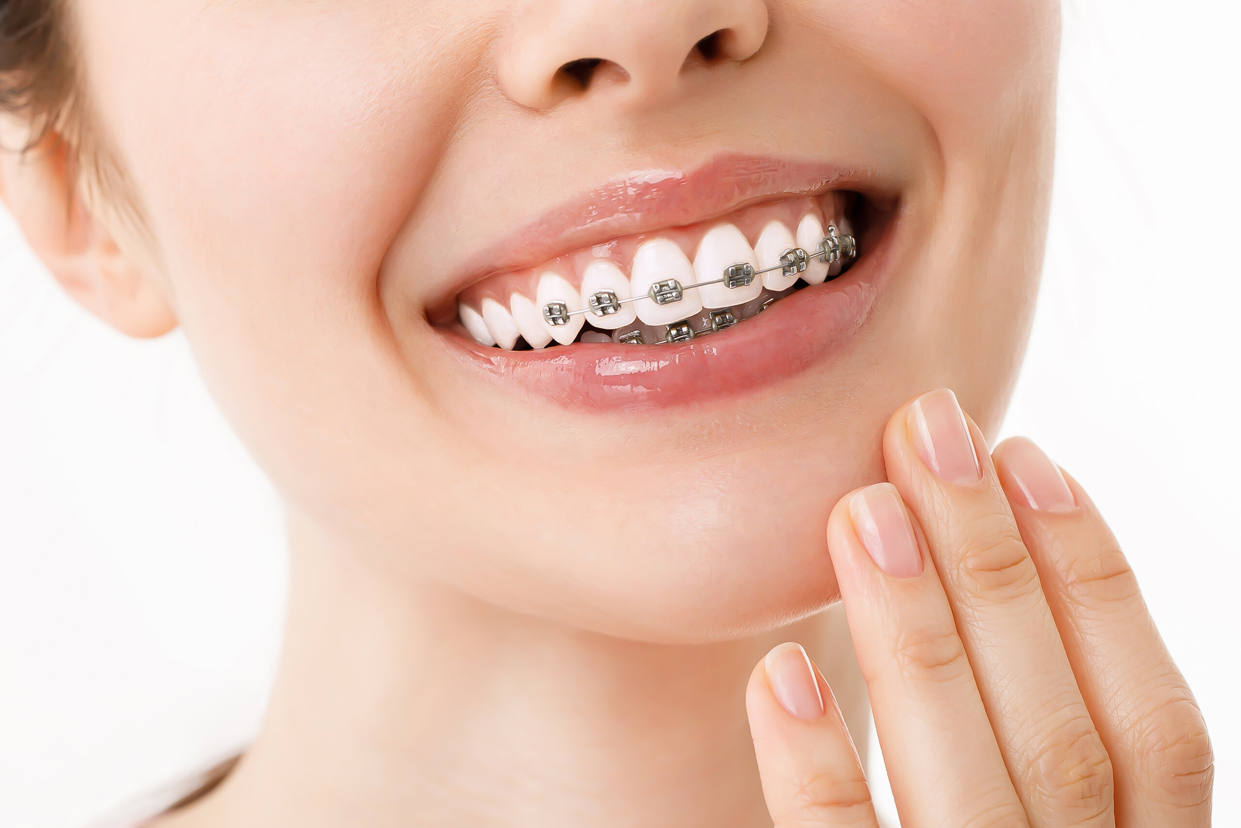 تقويم الأسنان - نخبة المجتمع