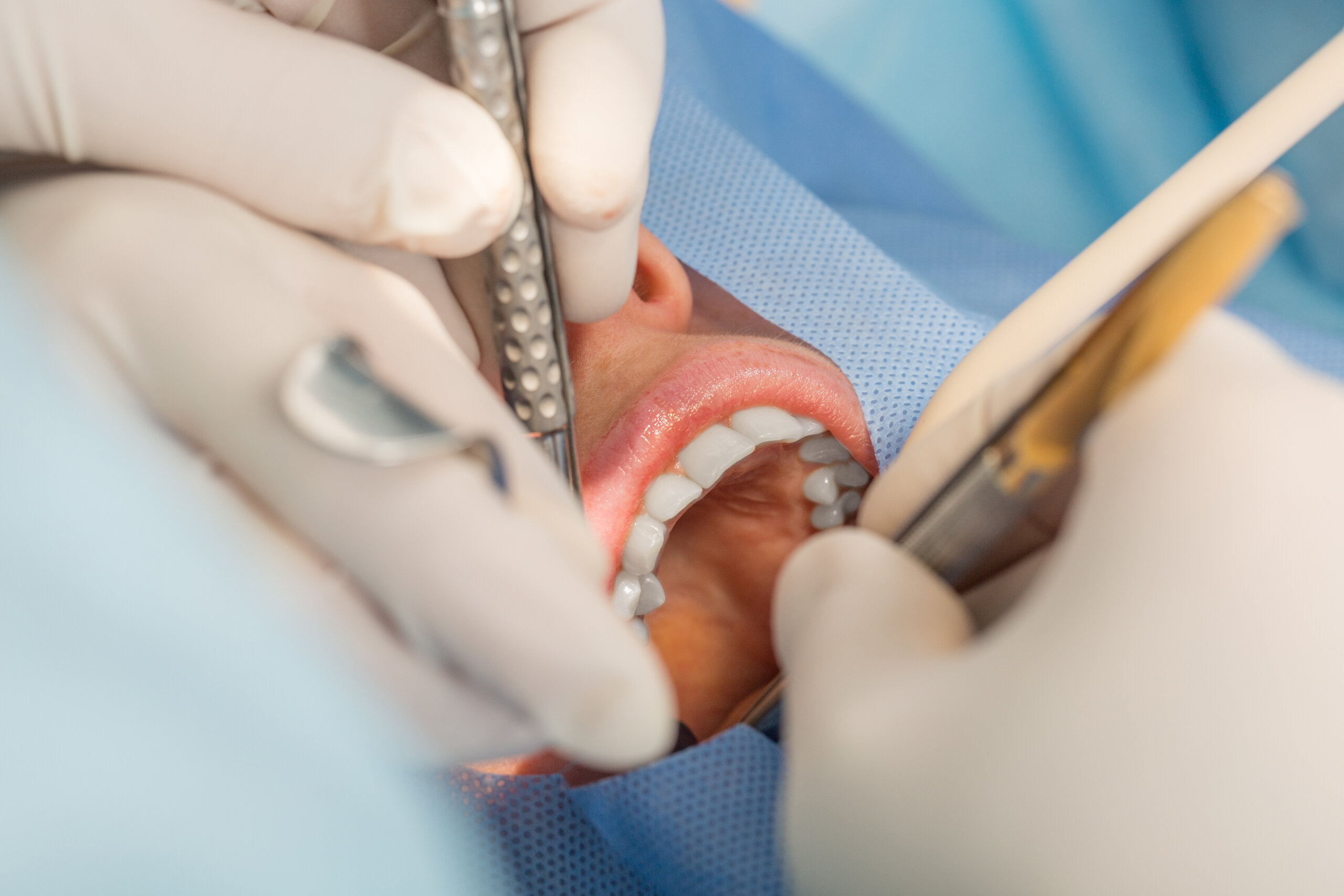 جراحة الوجه والفكين - نخبة المجتمع